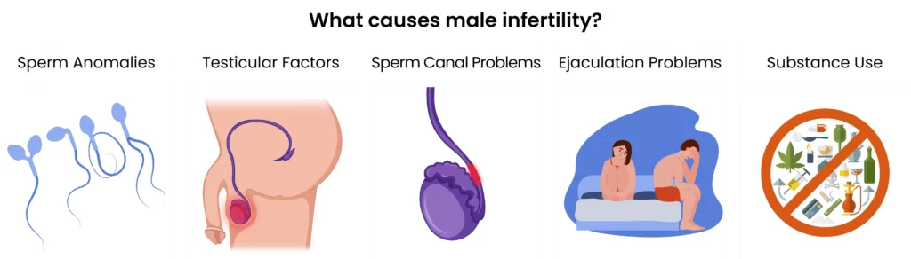 IVF and Male Infertility Causes Diagnosis and Treatment